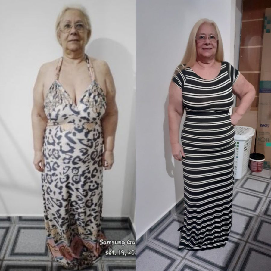 Antes e depois de uma aluna do Femme35
