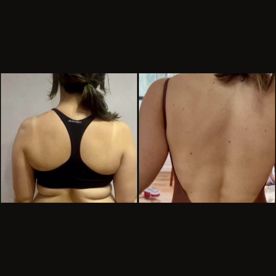 Antes e depois de uma aluna do Femme35